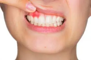 Periodontology