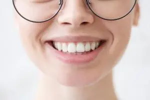Smile Design Smile Design