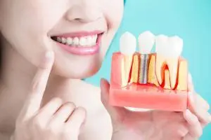 WHAT IS IMPLANT TOOTH? diş implantı nedir