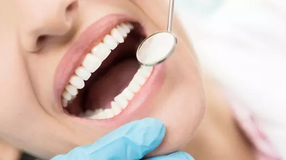 Tooth Decay Treatment