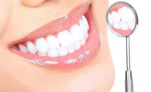 Diş Beyazlatma