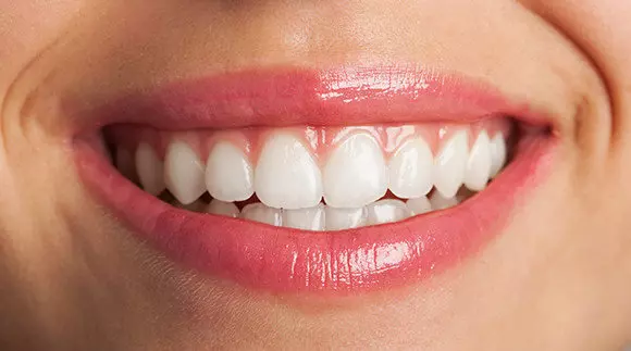 Lamınates Dental