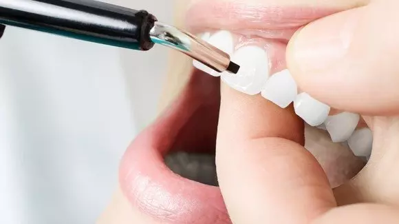 Perıodontology