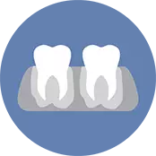 WHAT IS IMPLANT TOOTH?