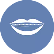 WHAT IS IMPLANT TOOTH?