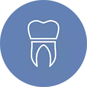 WHAT IS IMPLANT TOOTH?