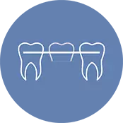 WHAT IS IMPLANT TOOTH?