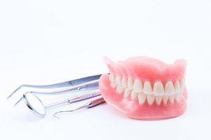 Dental Prostheses