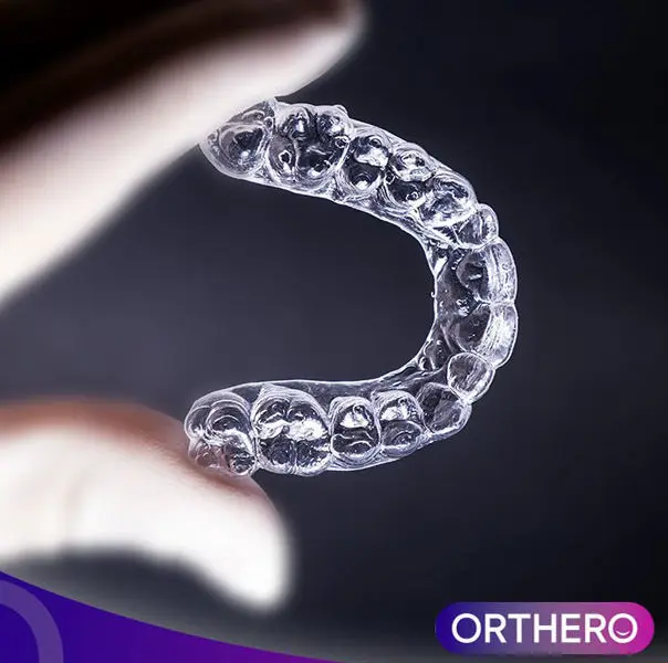 Orthero Transparent Plaque Experience