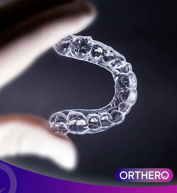 Orthero Transparent Plaque Experience