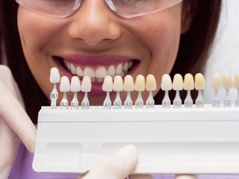 Types of dental composites