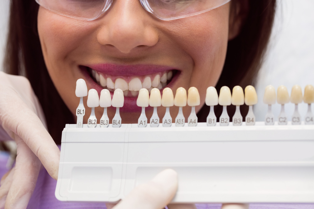 Types of dental composites