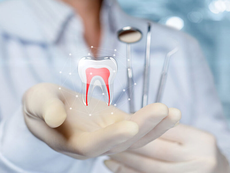 How To Do Root Canal Treatment