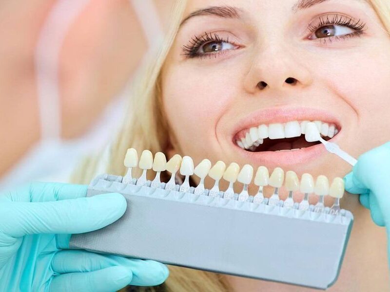 What Is Dental Prostheses